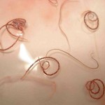 Angiostrongylus cantonensis