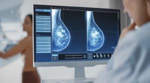 Mamografía